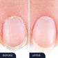 ✨Neue Produkteinführung🔥 Nagelpilz-Behandlungsstift für geschädigte Nägel